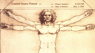 US Supreme Court Says Your Genes Can't Be Patented By Corporations